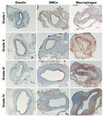 Alpha-Smooth Muscle Actin Antibody in Immunohistochemistry (IHC)