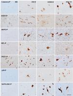 Phospho-ADD1/ADD2 (Ser726, Ser713) Antibody in Immunohistochemistry (IHC)