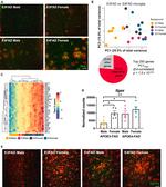 beta Amyloid Antibody in Immunohistochemistry (IHC)