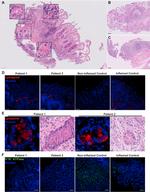 Lysozyme Antibody in Immunohistochemistry (IHC)