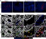 Lysozyme Antibody in Immunohistochemistry, Immunohistochemistry (Paraffin) (IHC, IHC (P))