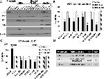 Progesterone Receptor Antibody in Western Blot (WB)