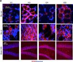 Rabbit IgG (H+L) Cross-Adsorbed Secondary Antibody in Immunohistochemistry (IHC)