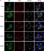 Rabbit IgG (H+L) Highly Cross-Adsorbed Secondary Antibody in Immunocytochemistry (ICC/IF)