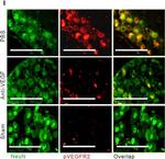 Rabbit IgG (H+L) Highly Cross-Adsorbed Secondary Antibody in Immunohistochemistry (Paraffin) (IHC (P))