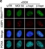 Mouse IgG (H+L) Highly Cross-Adsorbed Secondary Antibody in Immunocytochemistry (ICC/IF)