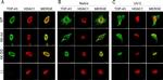 Rabbit IgG (H+L) Cross-Adsorbed Secondary Antibody in Immunocytochemistry (ICC/IF)