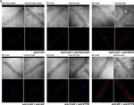 Rabbit IgG (H+L) Cross-Adsorbed Secondary Antibody in Immunocytochemistry (ICC/IF)