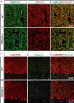 Rabbit IgG (H+L) Highly Cross-Adsorbed Secondary Antibody in Immunohistochemistry (IHC)