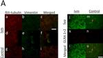 Mouse IgG (H+L) Cross-Adsorbed Secondary Antibody in Immunocytochemistry (ICC/IF)