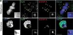 Rat IgG (H+L) Cross-Adsorbed Secondary Antibody in Immunocytochemistry (ICC/IF)