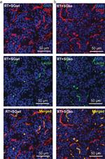 Rat IgG (H+L) Cross-Adsorbed Secondary Antibody in Immunohistochemistry (IHC)