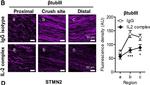 Rabbit IgG (H+L) Highly Cross-Adsorbed Secondary Antibody in Immunohistochemistry (IHC)