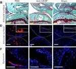 Rabbit IgG (H+L) Highly Cross-Adsorbed Secondary Antibody in Immunohistochemistry (Paraffin) (IHC (P))