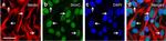 Mouse IgG (H+L) Cross-Adsorbed Secondary Antibody in Immunocytochemistry (ICC/IF)