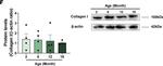 Rabbit IgG (H+L) Secondary Antibody in Western Blot (WB)