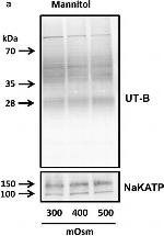 Rabbit IgG (H+L) Secondary Antibody in Western Blot (WB)