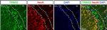 Rabbit IgG (H+L) Highly Cross-Adsorbed Secondary Antibody in Immunohistochemistry (IHC)