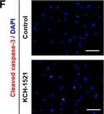 Rabbit IgG (H+L) Cross-Adsorbed Secondary Antibody in Immunocytochemistry (ICC/IF)