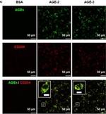 Rabbit IgG (H+L) Highly Cross-Adsorbed Secondary Antibody in Immunocytochemistry (ICC/IF)