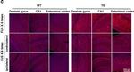 Rabbit IgG (H+L) Highly Cross-Adsorbed Secondary Antibody in Immunohistochemistry (Paraffin) (IHC (P))