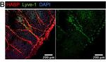 Goat IgG (H+L) Cross-Adsorbed Secondary Antibody in Immunohistochemistry (IHC)