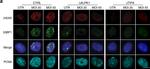 Rabbit IgG (H+L) Highly Cross-Adsorbed Secondary Antibody in Immunocytochemistry (ICC/IF)