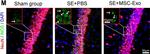 Mouse IgG (H+L) Highly Cross-Adsorbed Secondary Antibody in Immunohistochemistry (IHC)