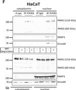 Rabbit IgG (H+L) Secondary Antibody in Western Blot (WB)