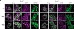 Mouse IgG (H+L) Highly Cross-Adsorbed Secondary Antibody in Immunocytochemistry (ICC/IF)