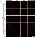 Rabbit IgG (H+L) Highly Cross-Adsorbed Secondary Antibody in Immunohistochemistry (Paraffin) (IHC (P))