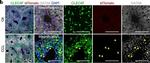 Rabbit IgG (H+L) Highly Cross-Adsorbed Secondary Antibody in Immunohistochemistry (PFA fixed) (IHC (PFA))