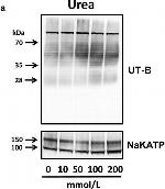 Rabbit IgG (H+L) Secondary Antibody in Western Blot (WB)