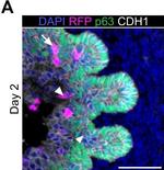 Goat IgG (H+L) Cross-Adsorbed Secondary Antibody in Immunohistochemistry (Paraffin) (IHC (P))