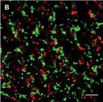 Mouse IgG (H+L) Highly Cross-Adsorbed Secondary Antibody in Immunocytochemistry (ICC/IF)