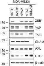 Goat IgG (H+L) Secondary Antibody in Western Blot (WB)