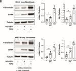 Mouse IgG, IgM, IgA (H+L) Secondary Antibody in Western Blot (WB)