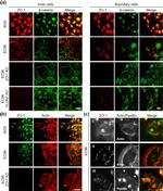 Mouse IgG (H+L) Cross-Adsorbed Secondary Antibody in Immunocytochemistry (ICC/IF)