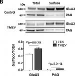 Rabbit IgG (H+L) Secondary Antibody in Western Blot (WB)