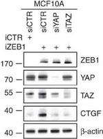 Goat IgG (H+L) Secondary Antibody in Western Blot (WB)