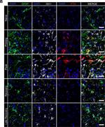 Rat IgG (H+L) Cross-Adsorbed Secondary Antibody in Immunohistochemistry (IHC)