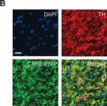 Rabbit IgG (H+L) Cross-Adsorbed Secondary Antibody in Immunohistochemistry (IHC)