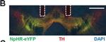 Rabbit IgG (H+L) Cross-Adsorbed Secondary Antibody in Immunohistochemistry (IHC)