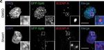 Rat IgG (H+L) Cross-Adsorbed Secondary Antibody in Immunocytochemistry (ICC/IF)