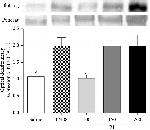 Rabbit IgG (H+L) Secondary Antibody in Western Blot (WB)