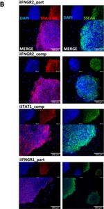 Mouse IgG (H+L) Highly Cross-Adsorbed Secondary Antibody in Immunocytochemistry (ICC/IF)