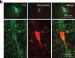 Mouse IgG (H+L) Cross-Adsorbed Secondary Antibody in Immunohistochemistry (IHC)