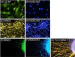 Rabbit IgG (H+L) Highly Cross-Adsorbed Secondary Antibody in Immunocytochemistry (ICC/IF)