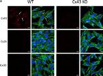 Rabbit IgG (H+L) Highly Cross-Adsorbed Secondary Antibody in Immunocytochemistry (ICC/IF)