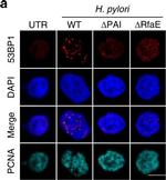 Rabbit IgG (H+L) Highly Cross-Adsorbed Secondary Antibody in Immunocytochemistry (ICC/IF)